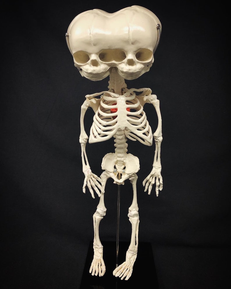 Réplique de squelette humain fœtal de jumeaux siamois sur pied avec véritable crâne triclops coeur d'animal image 4