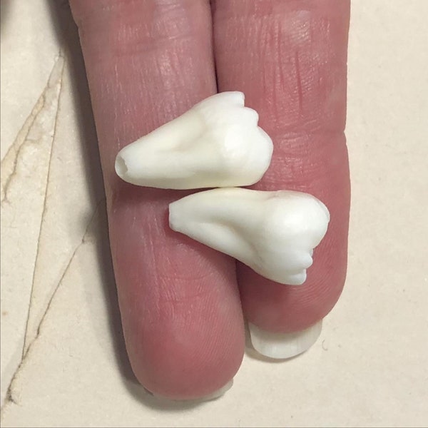 One Real Human Tooth with 1 Root or 2 Attached Roots