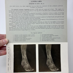 May include: Anatomy illustration of the lower limb, dorsum of the foot, with detailed labeling. The image shows the deep fascia removed, revealing the anterior annular ligament and tendons. The text includes a description of the foot's anatomy and a list of labeled figures.