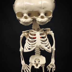 Réplique de squelette humain fœtal de jumeaux siamois sur pied avec véritable crâne triclops coeur d'animal image 8