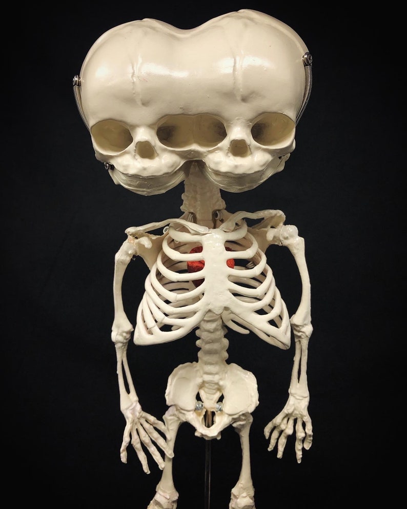 Réplique de squelette humain fœtal de jumeaux siamois sur pied avec véritable crâne triclops coeur d'animal image 8