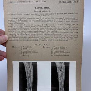 May include: Anatomy illustration from "The Edinburgh Stereoscopic Atlas of Anatomy," Section VIII, No. 24. The image shows a detailed black and white diagram of the lower limb, focusing on the back of the leg, with labels for muscles and nerves.