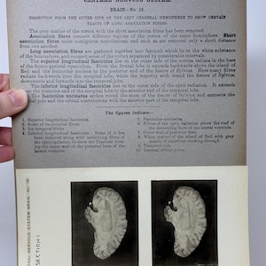 May include: Anatomy illustration from the Edinburgh Stereoscopic Atlas of Anatomy, Section I, No. 26, featuring a dissection of the left cerebral hemisphere. The image includes text and two black and white images of the brain.