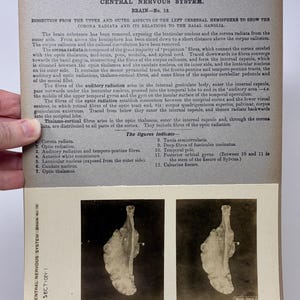 May include: Anatomy diagram from the Edinburgh Stereoscopic Atlas of Anatomy, featuring a dissection of the brain. The image includes text describing the central nervous system, brain structures, and labeled diagrams.