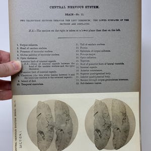 May include: An antique anatomical illustration from "The Edinburgh Stereoscopic Atlas of Anatomy." The page features text detailing the central nervous system, specifically the brain, with a list of labeled sections. Two grayscale images of brain sections are displayed.