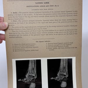 May include: Anatomy study of a lower limb, specifically the ankle and foot, from the Edinburgh Stereoscopic Atlas of Anatomy. The image shows a detailed view of the ligaments, with text descriptions and diagrams. The image is in black and white.