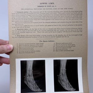 May include: Anatomy illustration from the Edinburgh Stereoscopic Atlas of Anatomy. The image shows a black and white photograph of a foot and lower leg, with detailed anatomical labels and text. The text describes the superficial structures of the lower limb.