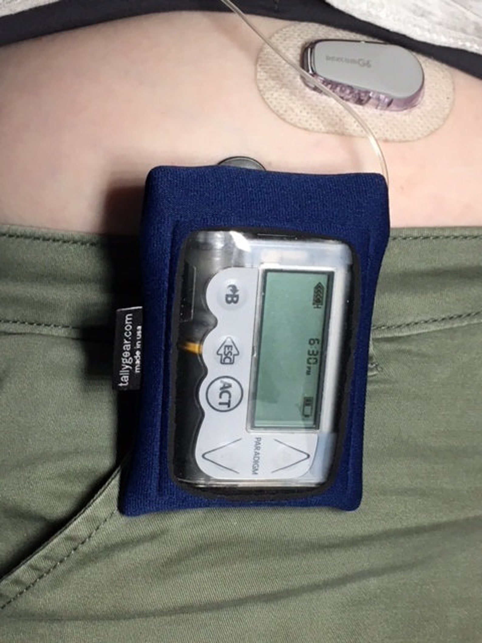 Insulin Pump Case Insulin Pump Pouch Tslim Insulin Pump Etsy