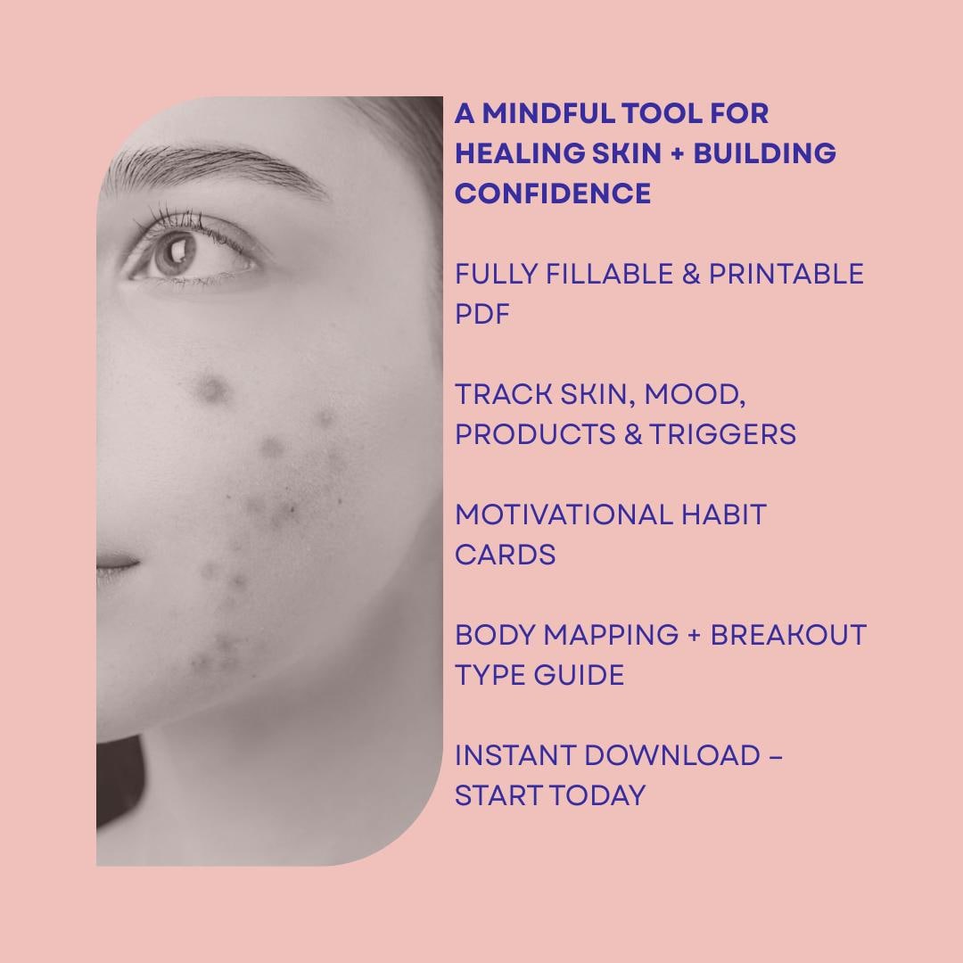 Acne Journal Printable: Skin Tracker, Mood Log, Habit Cards (fillable ...