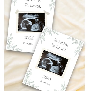 May include: Two white cards featuring ultrasound scans of a foetus. The cards display the text "So Little, So Loved." and "Noah, 12 Weeks." They have a decorative green leaf and vine border. The ultrasound image is taped to the card.