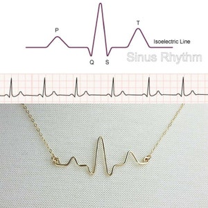 Custom Heartbeat Necklace •  Miscarriage Keepsake . Pregnancy Gift • New Mom Necklace