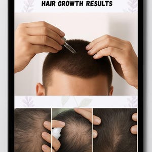 Regrow your Hair, Stop the Shedding, Age, Stress, Diet, GLP1 Injections, Herbal Hair Guide with DIY Remedies, 57 Pgs, 12 Pg Calendar. image 12