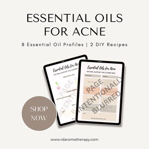May include: Two digital tablets displaying information about essential oils for acne. The tablets show the text "Essential Oils for Acne" and "Natural Support for Clearer Skin." A circular button with "Shop Now" is also visible.