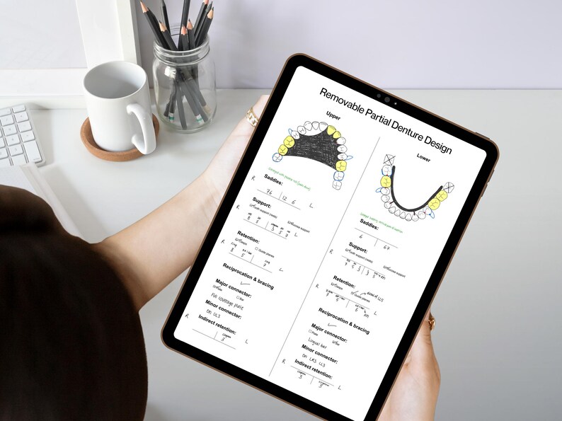 RPD Design Template: Printable Guide for Dentists & Students (PDF ...