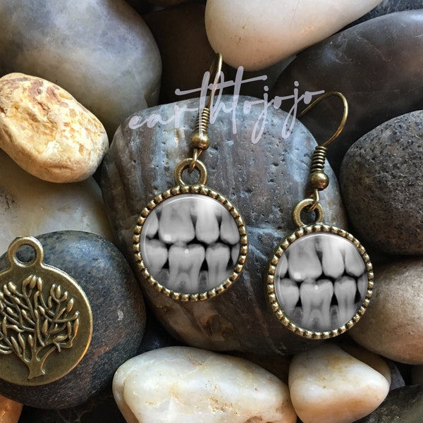 Dental X Ray Antique Bronze Glass Domed Dangle Earrings