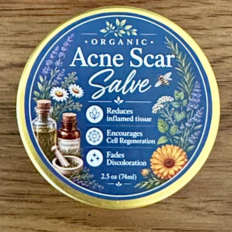Acne and Scar Treatment - Etsy