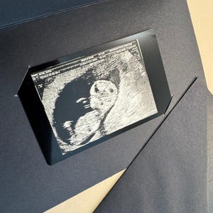 Regalo per neo-papà, regali per futuri papà, regalo per ecografia, regali per neo-papà, regalo per ecografia, immagine dell'ecografia, biglietto d'auguri per ecografia, annuncio per il papà