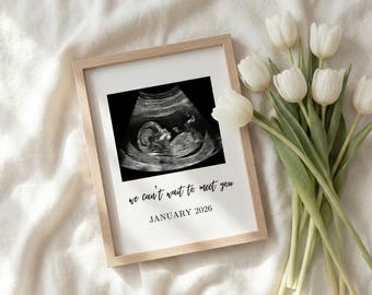 Puede incluir: Una imagen de ultrasonido enmarcada con el texto "we can't wait to meet you" y "JANUARY 2026". El marco es de madera clara y la imagen está sobre un fondo blanco. Un ramo de tulipanes blancos está a la derecha.