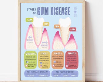 Gum Disease Poster, Dental Office Decoration, Periodontal Wall Art for Dentist Patient Education