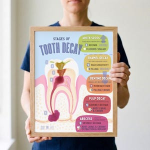 May include: A framed educational poster titled Stages of Tooth Decay, featuring a cross-section illustration of a tooth with numbered decay progression. The chart details five stages including white spots, enamel, dentine, pulp decay, and abscess.