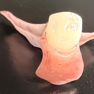 May include: A close-up of a dental crown with a pinkish-red gum-like base and a light yellow, glossy crown. The crown is surrounded by a thin, translucent, pinkish-white material, possibly a dental impression. The background is dark.