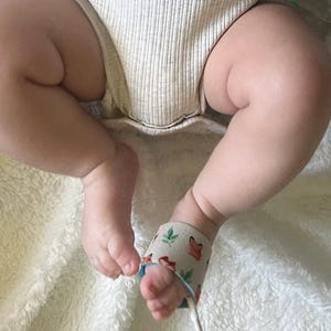 以下が含まれることがあります： 赤ちゃんの足と足のクローズアップ。赤ちゃんは明るい色のロンパースを着ています。赤と緑のデザインの模様入りのバンドが足首に巻かれ、ワイヤーが付いています。