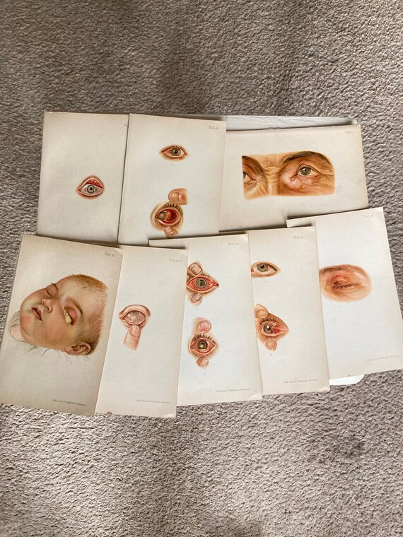 Antique Medical Prints Etsy