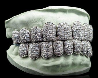 Iced Out D Color Moissanite Grillz: Custom Fit Hip Hop Jewelry