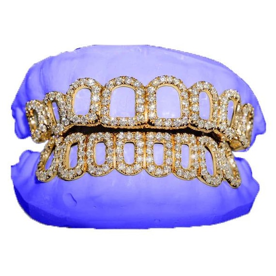 Custom Moissanite Open Face Grillz: Iced Out Hip Hop Teeth Jewelry