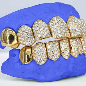 Custom VVS Moissanite Grillz | Iced Out Hip Hop End Cap Grillz | Bling Teeth Jewelry | Shine Bright Grillz for Men & Women