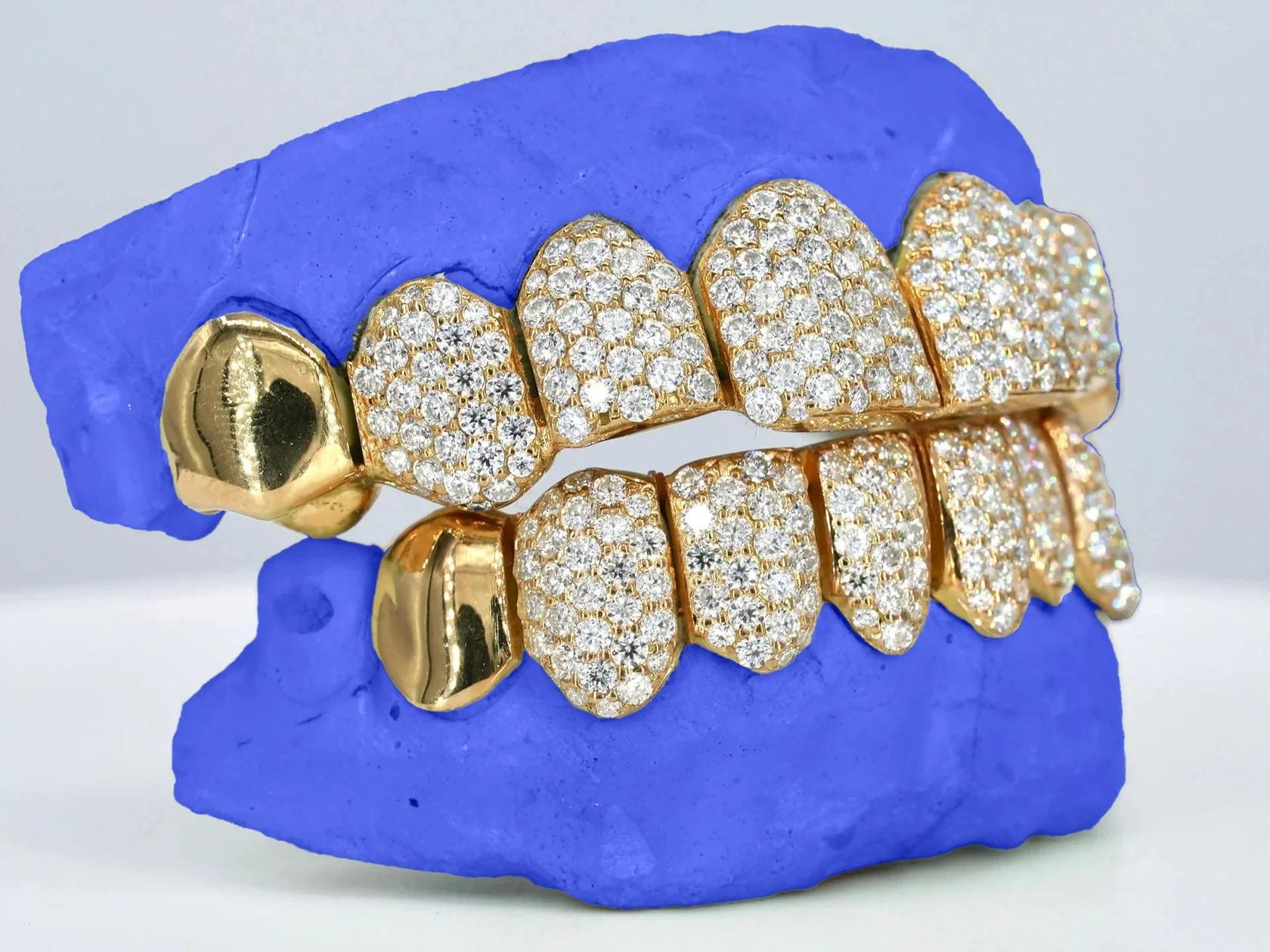 Custom VVS Moissanite Grillz: Iced Out Hip Hop Teeth Jewelry