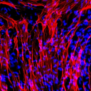 Op de afbeelding: Abstracte microscopische afbeelding met een netwerk van rode, draadachtige structuren tegen een donkere achtergrond. Kleine blauwe vormen zijn verspreid over de afbeelding, waardoor een complex patroon ontstaat.