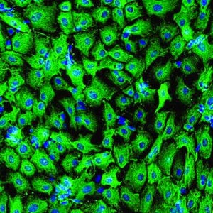 Puede incluir: Imagen microscópica de células, predominantemente verdes con núcleos azules. Las células están densamente empaquetadas, creando un patrón orgánico texturizado. La imagen resalta las estructuras celulares, con enfoque en los núcleos y límites celulares.