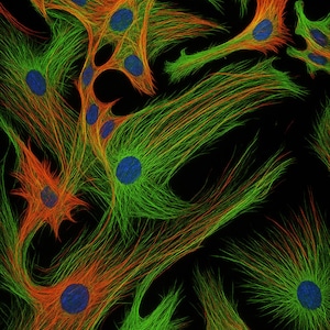 Op de afbeelding: Abstracte afbeelding van cellen met groene en oranje filamenten die uitstralen van blauwe kernen tegen een zwarte achtergrond. De cellen hebben een stervormig uiterlijk, waarbij de filamenten een textuureffect creëren.