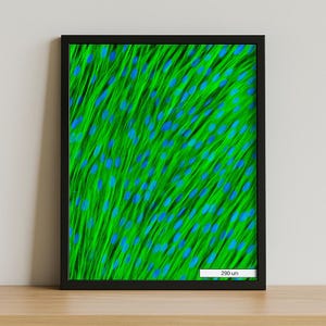 Op de afbeelding: Een ingelijste microscopische afbeelding met een zwarte rand. De afbeelding toont een levendige groene achtergrond met talrijke blauwe ovale vormen. De tekst "290 um" is rechtsonder zichtbaar, wat de schaal van de afbeelding aangeeft.