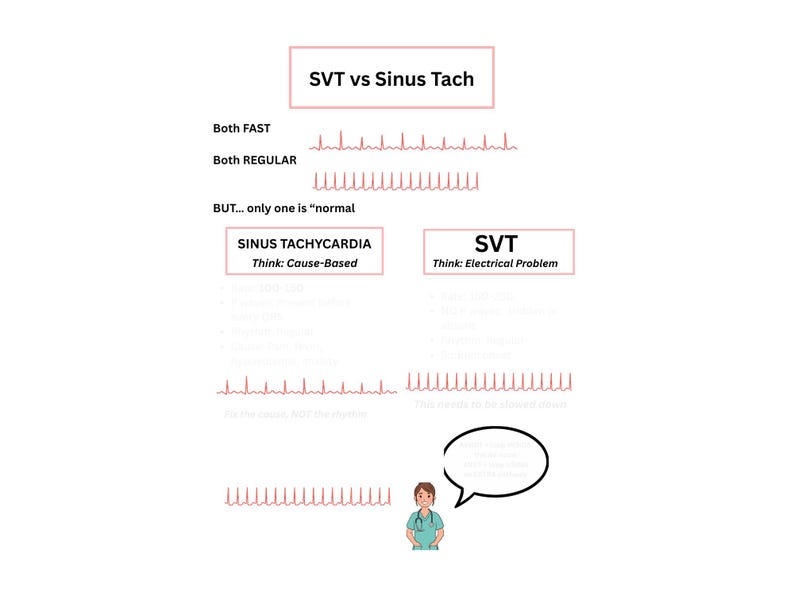 ECG Rhythm Bundle | SVT, A-fib & V-tach Study Guides | Cardiac Rhythm ...