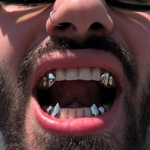 Könnte beinhalten: Ein Set aus silberfarbenen Metall-Zahnkappen in Form von Fangzähnen, die auf den oberen und unteren Eckzähnen getragen werden. Die metallischen Abdeckungen haben eine glatte, reflektierende Oberfläche und sitzen auf den natürlichen Zähnen.