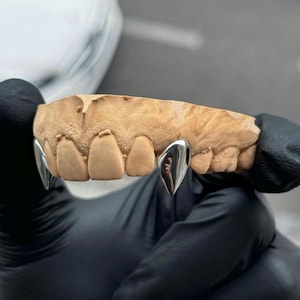 May include: A dental mould of a human upper jaw featuring two polished silver-coloured metal canine tooth caps. The mould is tan-coloured and textured, showing the gum line and individual teeth, with the metallic fangs fitted over the natural teeth.
