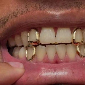 Custom Made To Fit Open Face Window Caps | Single & Full Mouth Grillz Gold Or Silver