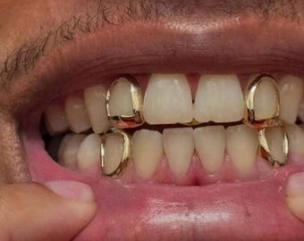 Custom Made To Fit Open Face Window Caps | Single & Full Mouth Grillz Gold Or Silver