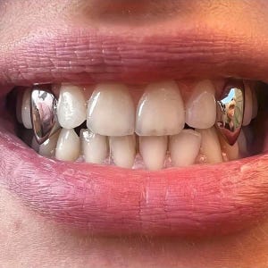 Può includere: Primo piano della bocca di una persona con lucenti cappucci dentali argentati sui canini. Le labbra della persona sono di un colore rosa naturale e i denti sono bianchi. I cappucci argentati riflettono l'ambiente circostante.