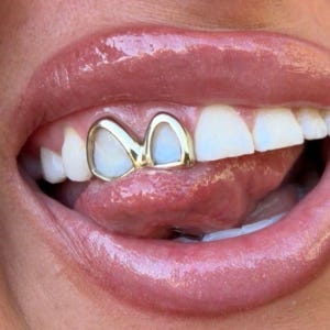 Custom Double Window Grillz: Silver or Gold Caps