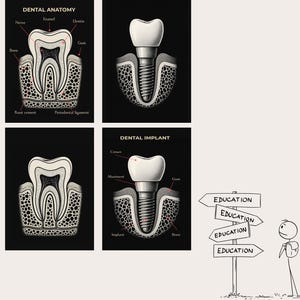 Póster de anatomía dental y póster de anatomía de implantes dentales (juego de 2) / Etiquetado y sin etiquetar / Descarga digital. Pósteres educativos de odontología.