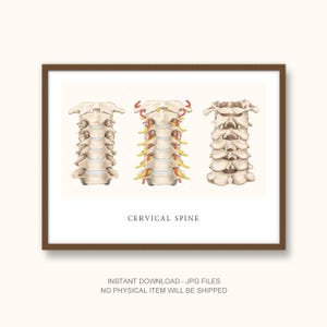 Cervical Spine Anatomy Poster – Medical Illustration of Neck Vertebrae, Patient Education Chart, Digital Download (JPG, 300 DPI)