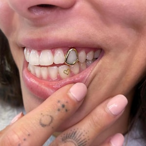 Open Face Window Cap — Handmade Custom Personalised Fit Grillz in Sterling Silver or Gold | Any Teeth! Free Mould Kit Included!