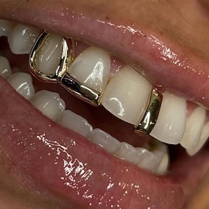 Window Inlay Tip Cap In Dental Gold & Sterling Silver Custom Made Grillz Any Teeth FREE Shipping! Free Mould Kit Included!