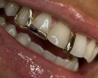Window Inlay Tip Cap In Dental Gold & Sterling Silver Custom Made Grillz Any Teeth FREE Shipping! Free Mould Kit Included!