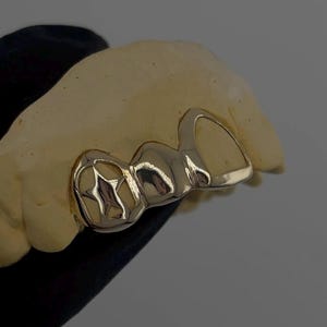 Star, Plain And Open Face Window — Handmade Custom Personalised Fit Grillz in Sterling Silver or Gold | Any Teeth! Free Mould Kit Included!