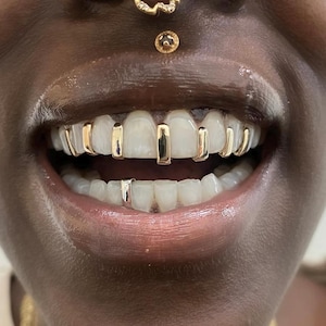 Plain Gold Gap Filler Caps — Handmade Custom Personalised Fit Grillz in Sterling Silver or Gold | Any Teeth! Free Mould Kit Included!
