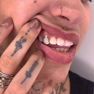 Open Face Window Cap — Handmade Custom Personalised Fit Grillz in Sterling Silver or Gold | Any Teeth! Free Mould Kit Included!